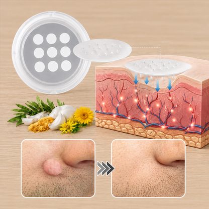 ✨Coredew®2-in-1 Microneedle & Hydrocolloid Patch🍀| Removes Raised Moles, Acne, Flat Warts & Skin Tags | Helps Improve Wrinkles, Scars & Blemishes | Invisible Patches for Face & Body