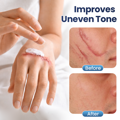 🔥Last Day Discount🔥 Coredew® DERMALUX Texture Repair Gel