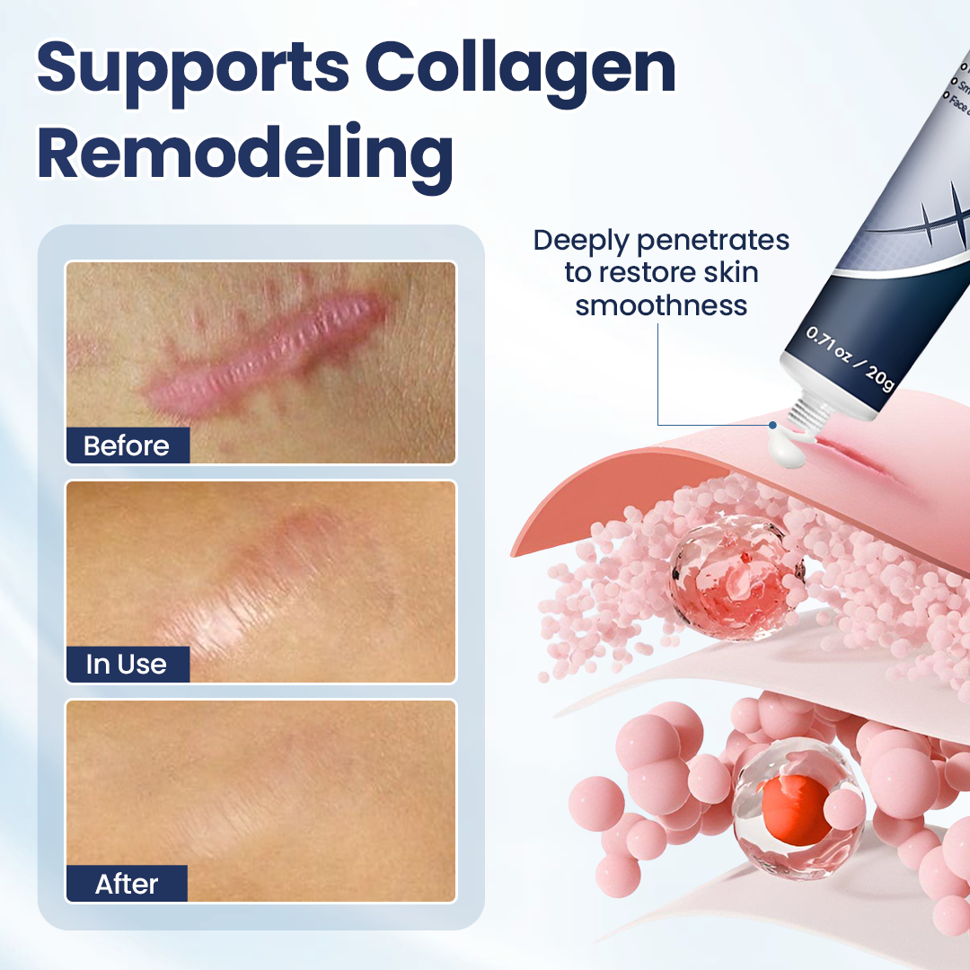 🔥Last Day Discount🔥 Coredew® DERMALUX Texture Repair Gel