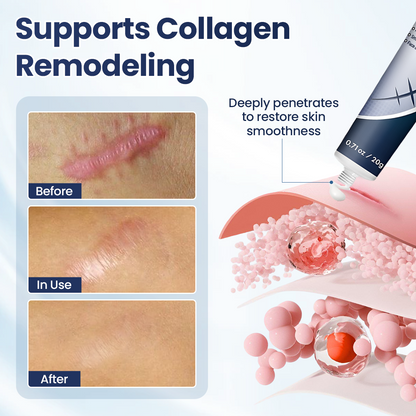 🔥Last Day Discount🔥 Coredew® DERMALUX Texture Repair Gel