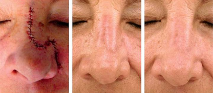 🔥Last Day Discount🔥 Coredew® DERMALUX Texture Repair Gel