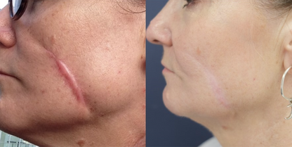 🔥Last Day Discount🔥 Coredew® DERMALUX Texture Repair Gel